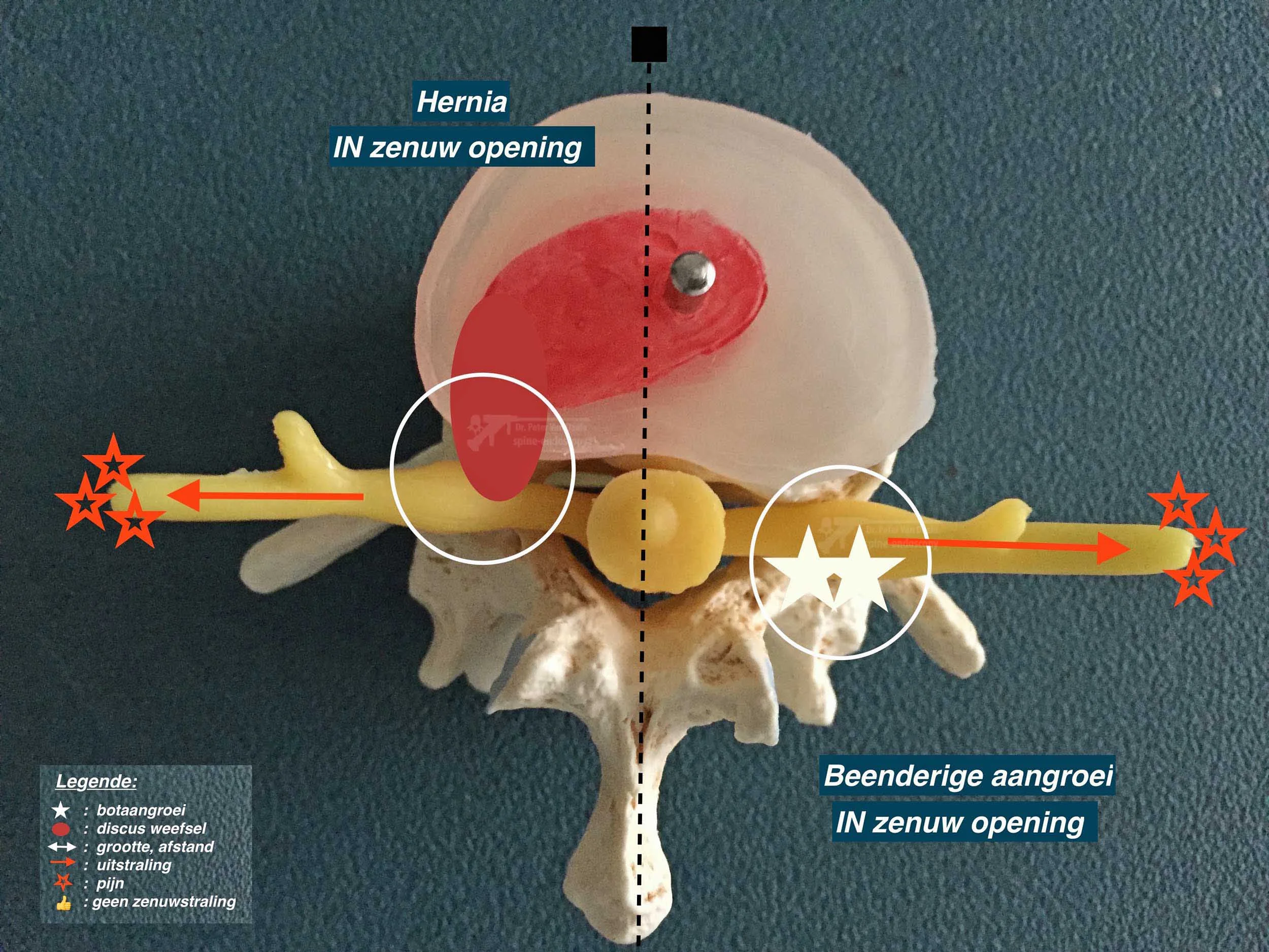 Sciatica & Arm Pain | Nerve Pain Causes & Solutions — Spine